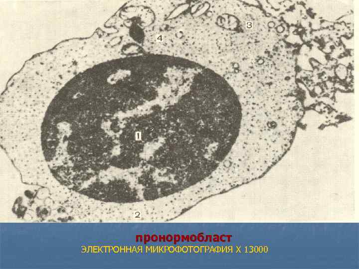  пронормобласт ЭЛЕКТРОННАЯ МИКРОФОТОГРАФИЯ X 13000 