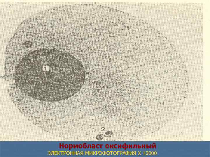  Нормобласт оксифильный ЭЛЕКТРОННАЯ МИКРОФОТОГРАФИЯ X 12000 