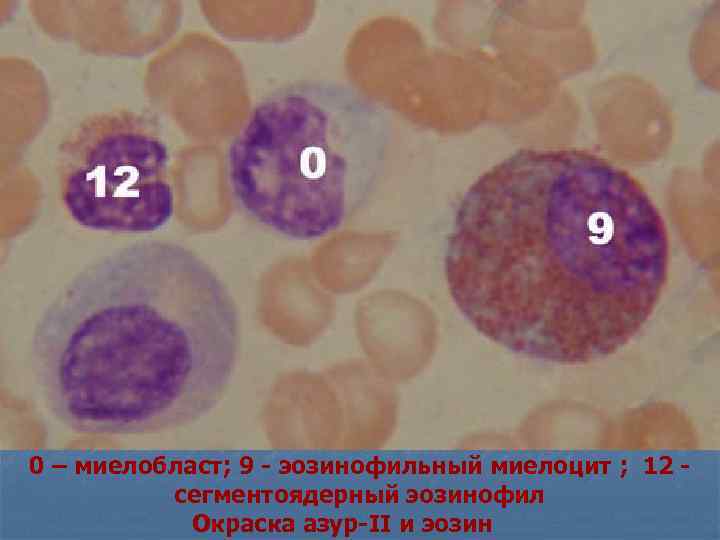 Промиелоциты в крови фото под микроскопом