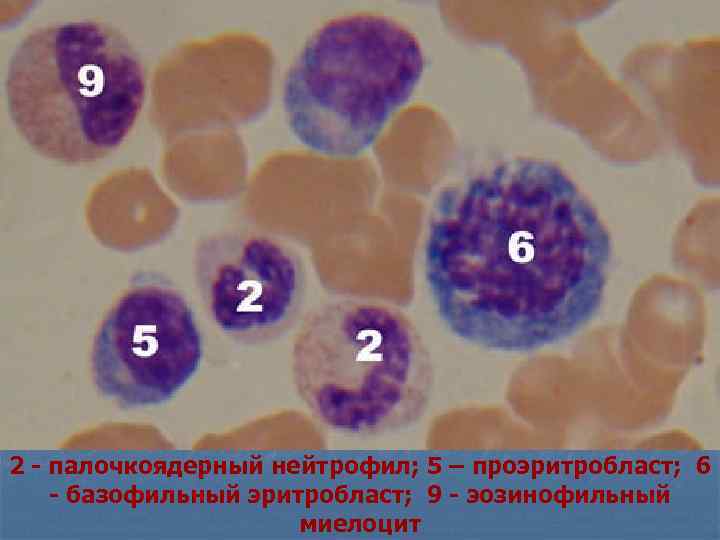 Палочкоядерные. Проэритробласт базофильный эритробласт. Базофильный миелоцит. Миелоцит палочкоядерный. Базофильный миелоцит под микроскопом.