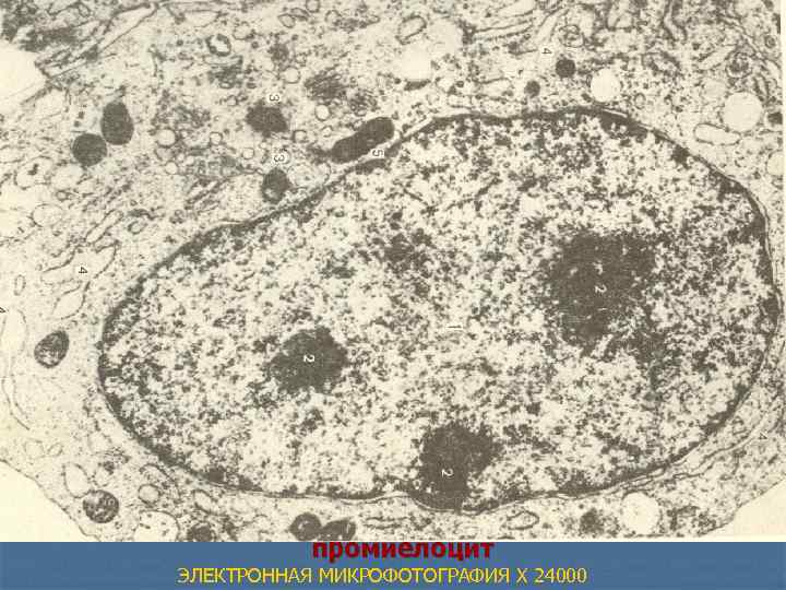  промиелоцит ЭЛЕКТРОННАЯ МИКРОФОТОГРАФИЯ X 24000 