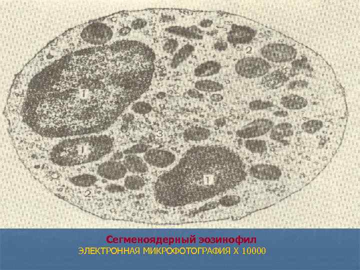  Сегменоядерный эозинофил ЭЛЕКТРОННАЯ МИКРОФОТОГРАФИЯ X 10000 
