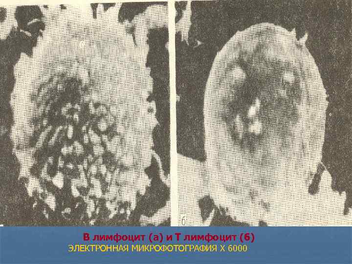  В лимфоцит (а) и Т лимфоцит (б) ЭЛЕКТРОННАЯ МИКРОФОТОГРАФИЯ X 6000 