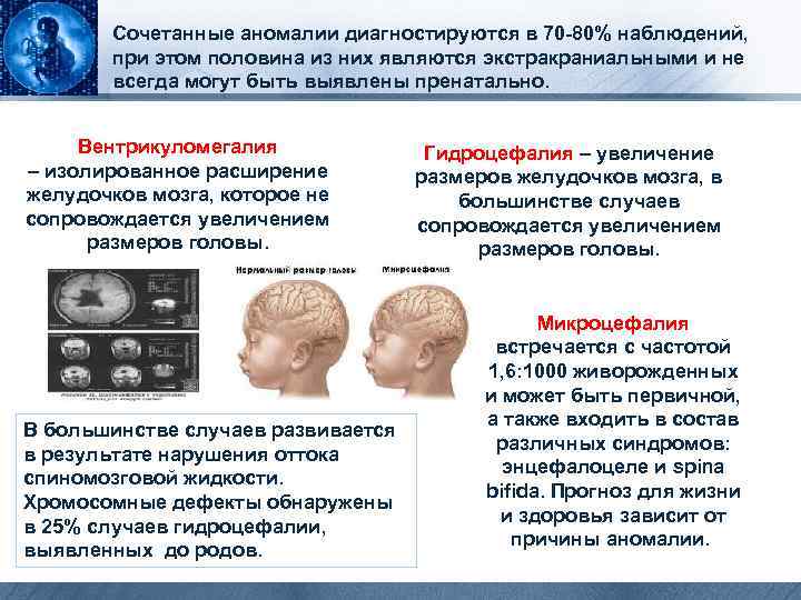  Сочетанные аномалии диагностируются в 70 -80% наблюдений, при этом половина из них являются