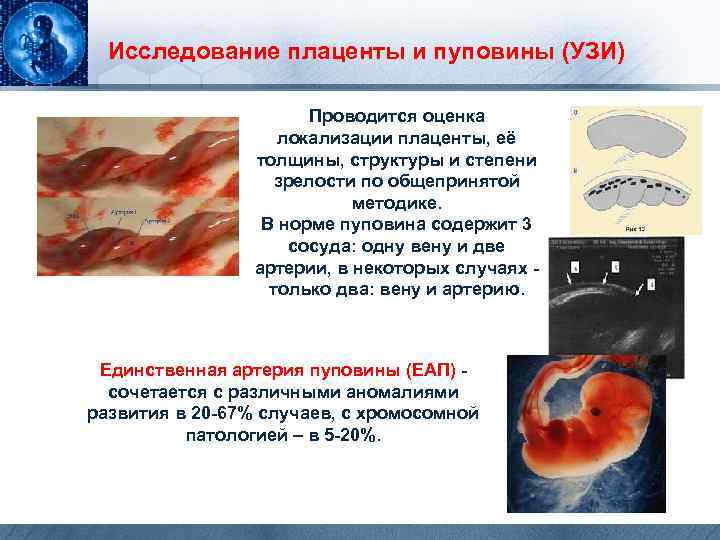  Исследование плаценты и пуповины (УЗИ) Проводится оценка локализации плаценты, её толщины, структуры и