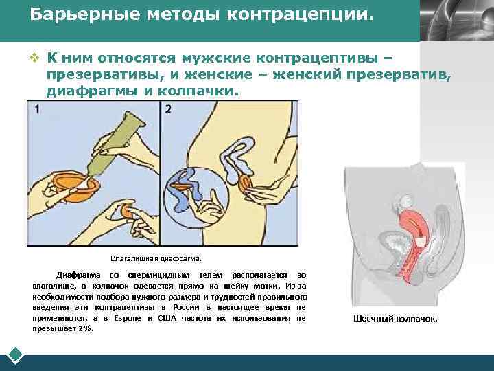 Барьерные методы контрацепции. LOGO v К ним относятся мужские контрацептивы – презервативы, и женские