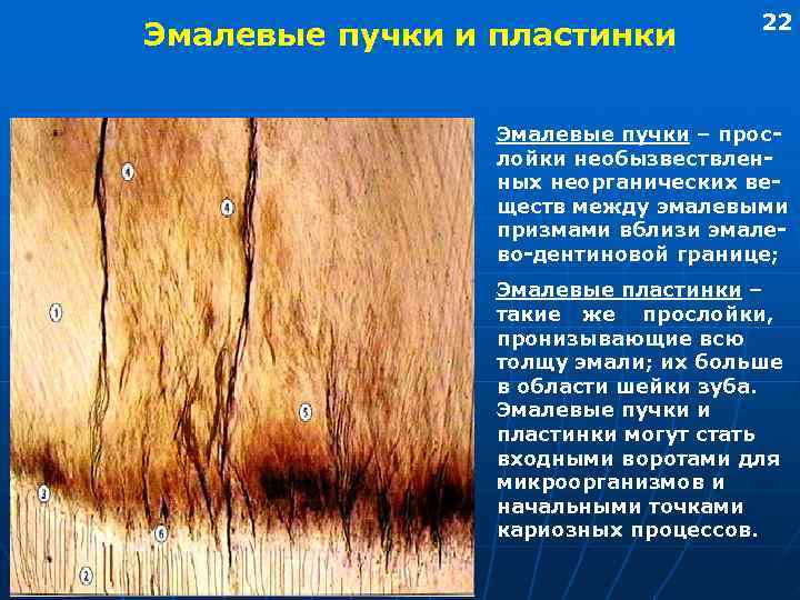        22 Эмалевые пучки и пластинки  