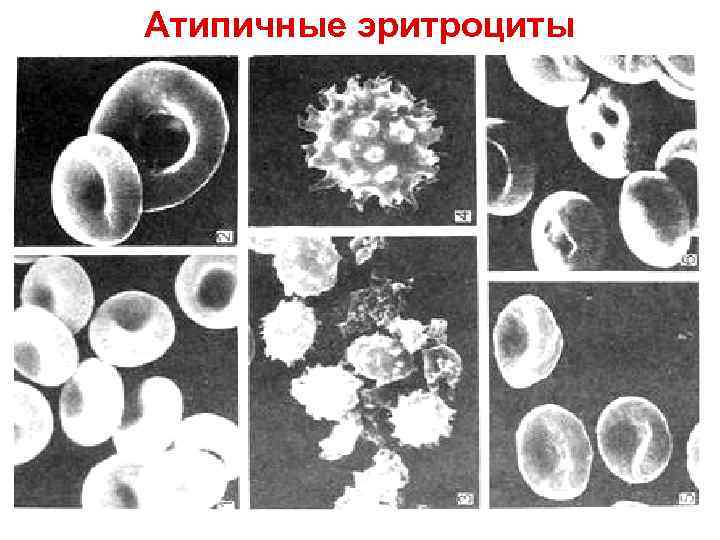 Ретикулоциты Ретикулоциты
