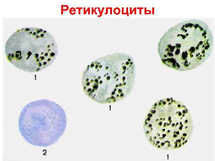 Ретикулоциты (по Г. А. Алексееву и И. А. Кассирскому) Ретикулоциты (по Г. А. Алексееву и И. А. Кассирскому)