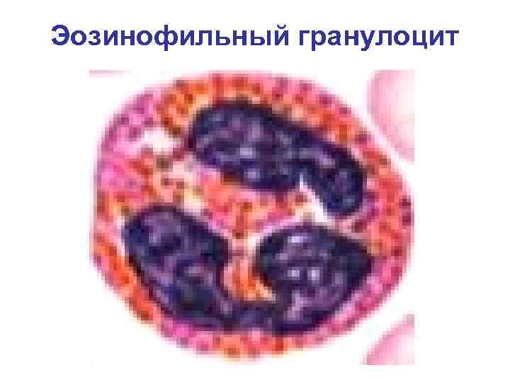 Эозинофильный гранулоцит Эозинофильный гранулоцит