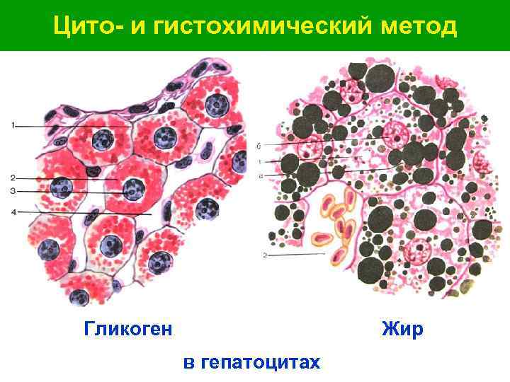 Цито- и гистохимический метод Гликоген Жир в гепатоцитах 