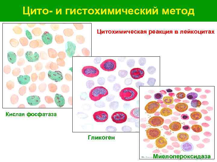  Цито- и гистохимический метод Цитохимическая реакция в лейкоцитах Кислая фосфатаза Гликоген Миелопероксидаза 