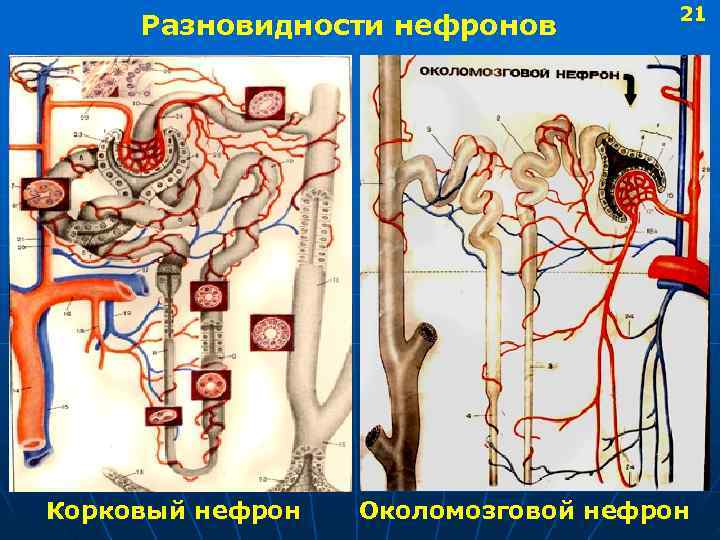  21 Разновидности нефронов Корковый нефрон Околомозговой нефрон 