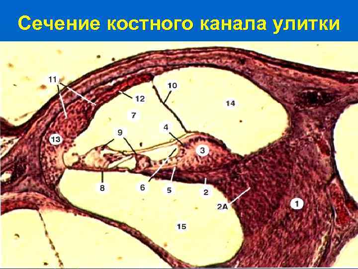 Сечение костного канала улитки 