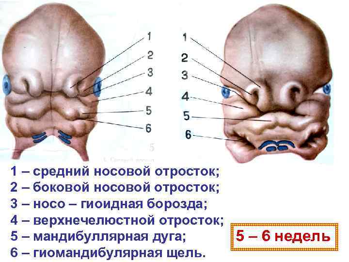 1 – средний носовой отросток; 2 – боковой носовой отросток; 3 – носо –