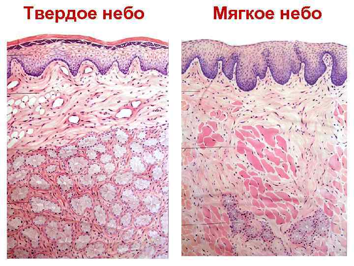 Твердое небо Мягкое небо 