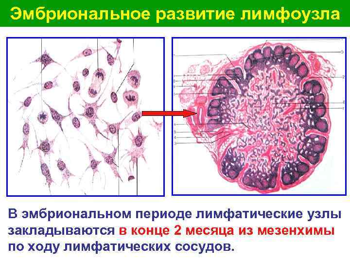 Эмбриональное развитие лимфоузла В эмбриональном периоде лимфатические узлы закладываются в конце 2 месяца из