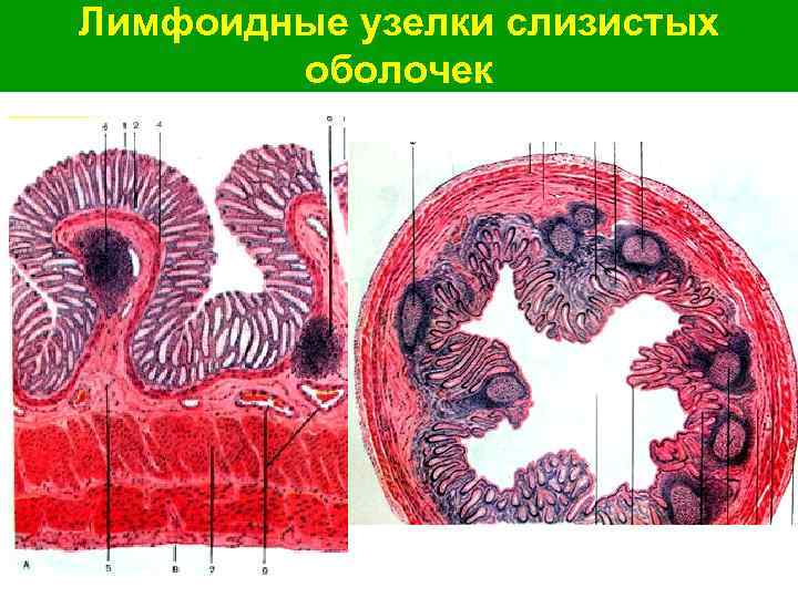 Лимфоидные узелки слизистых оболочек 