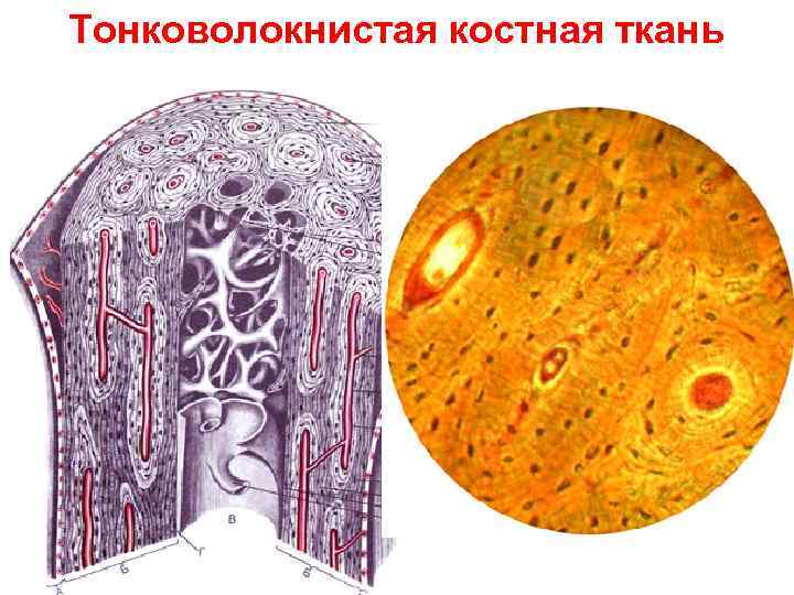 Тонковолокнистая костная ткань 