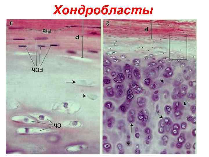 Хондробласты 