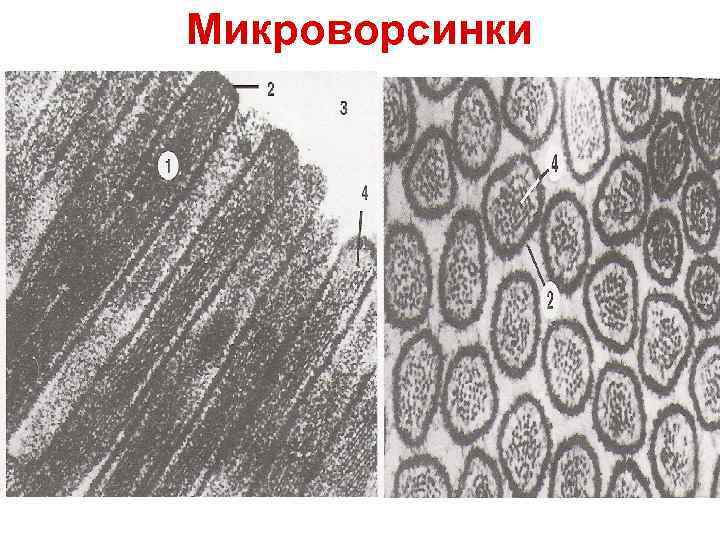 Микроворсинки 