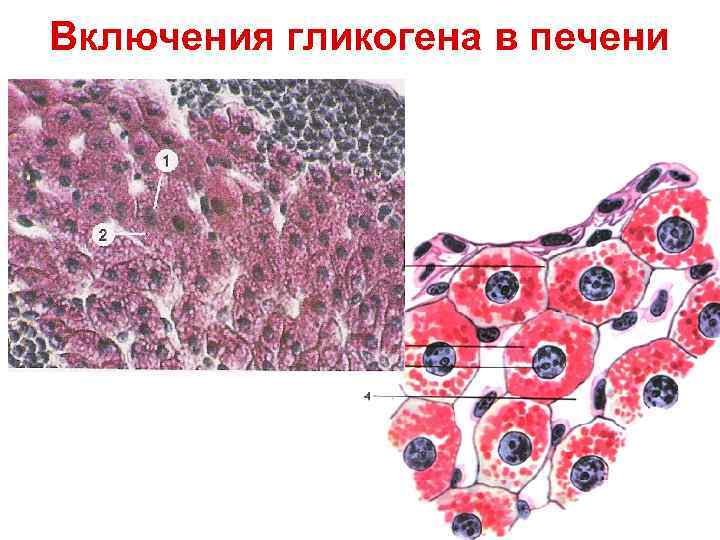 Включения гликогена в печени 