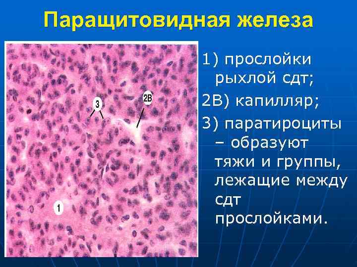 Паращитовидная железа 1) прослойки рыхлой сдт; 2 В) капилляр; 3) паратироциты – образуют тяжи