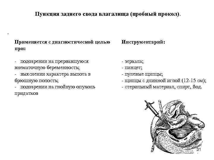  Пункция заднего свода влагалища (пробный прокол). . Применяется с диагностической целью Инструментарий: при: