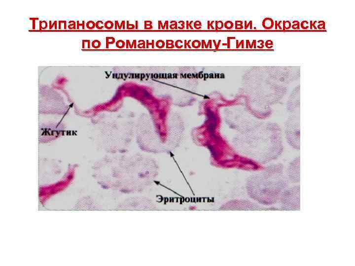 Трипаносомы в мазке крови. Окраска по Романовскому-Гимзе 