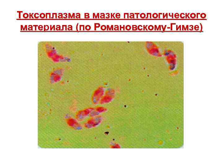 Токсоплазма в мазке патологического материала (по Романовскому-Гимзе) 