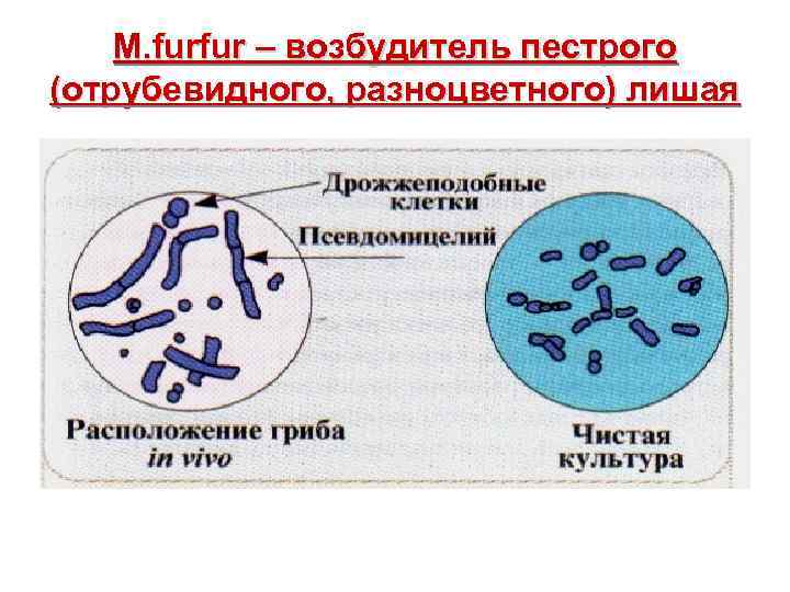  M. furfur – возбудитель пестрого (отрубевидного, разноцветного) лишая 