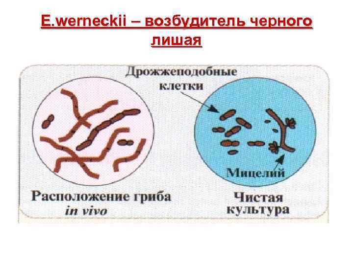 E. werneckii – возбудитель черного лишая 