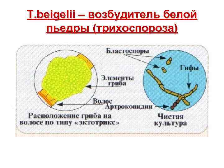 T. beigelii – возбудитель белой пьедры (трихоспороза) 