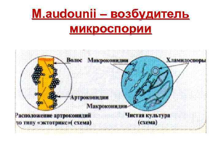 M. audounii – возбудитель микроспории 