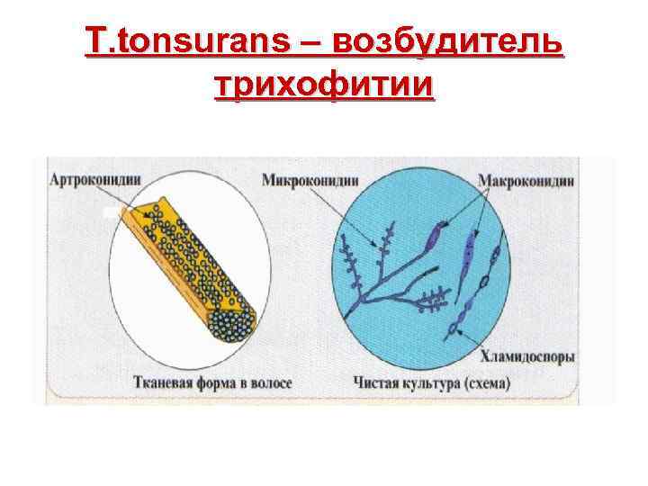 T. tonsurans – возбудитель трихофитии 