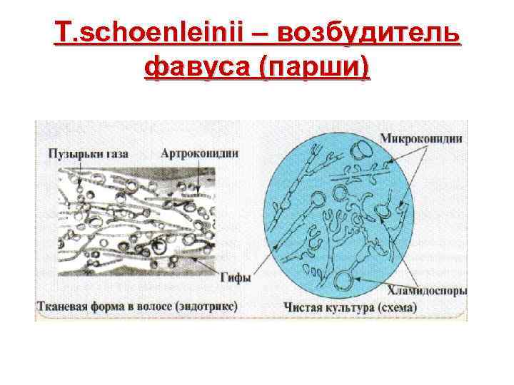 T. schoenleinii – возбудитель фавуса (парши) 