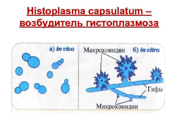  Histoplasma capsulatum – возбудитель гистоплазмоза 