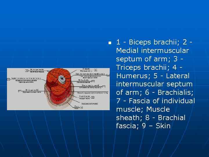 n  1 - Biceps brachii; 2 - Medial intermuscular septum of arm; 3