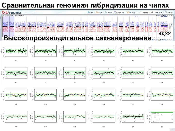 Сравнительная геномная гибридизация на чипах     46, XX Высокопроизводительное секвенирование 