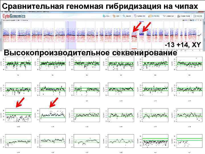 Сравнительная геномная гибридизация на чипах    -13 +14, XY Высокопроизводительное секвенирование 