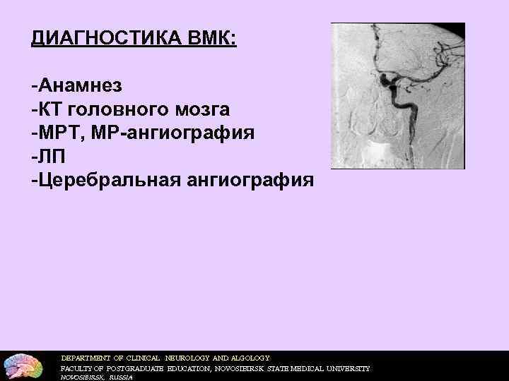ДИАГНОСТИКА ВМК:  Анамнез КТ головного мозга МРТ, МР-ангиография ЛП Церебральная ангиография  DEPARTMENT