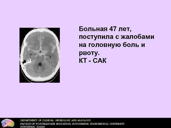     Больная 47 лет,       поступила