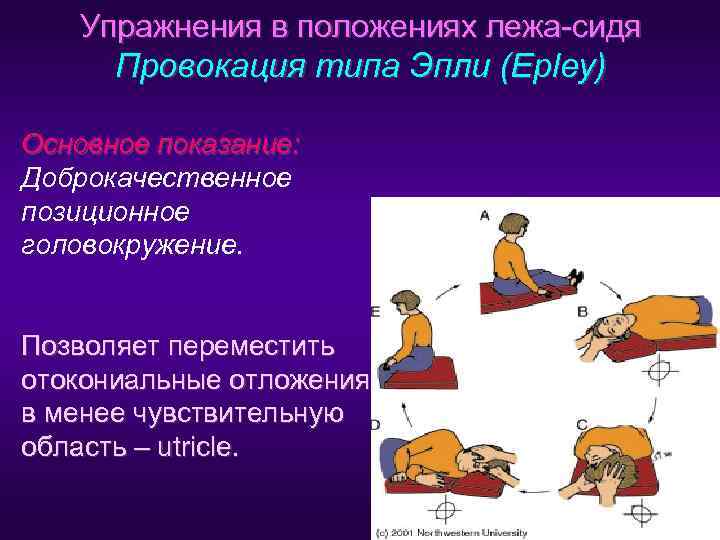   Упражнения в положениях лежа-сидя  Провокация типа Эпли (Epley) Основное показание: Доброкачественное