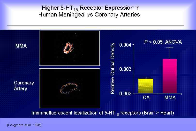  Higher 5 -HT 1 B Receptor Expression in Human Meningeal vs Coronary Arteries