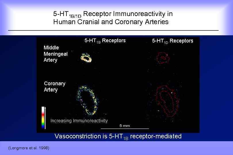  5 -HT 1 B/1 D Receptor Immunoreactivity in Human Cranial and Coronary Arteries