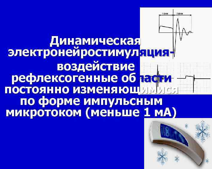  Динамическая электронейростимуляция- воздействие рефлексогенные области постоянно изменяющимися по форме импульсным микротоком (меньше 1