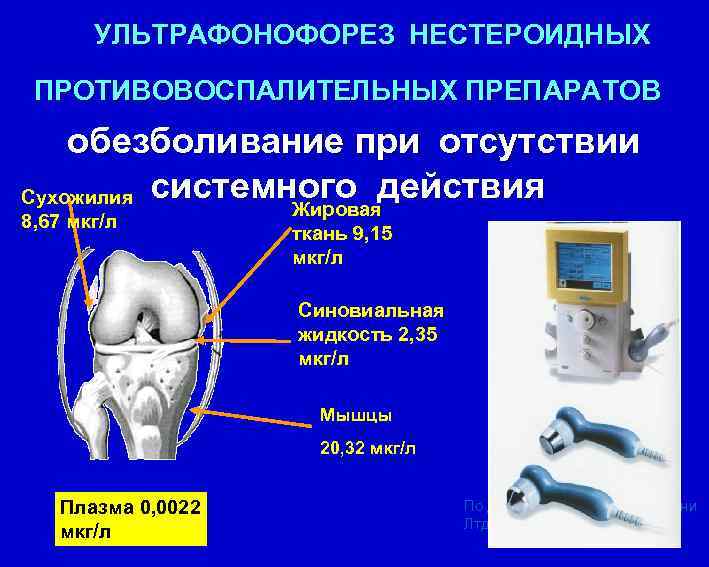  УЛЬТРАФОНОФОРЕЗ НЕСТЕРОИДНЫХ ПРОТИВОВОСПАЛИТЕЛЬНЫХ ПРЕПАРАТОВ обезболивание при отсутствии Сухожилия системного действия Жировая 8, 67