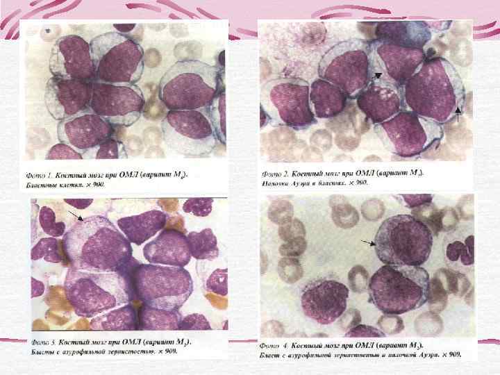   Преимущества метода лазерной  проточной цитофлюориметрии - исследование большого количества клеток (более