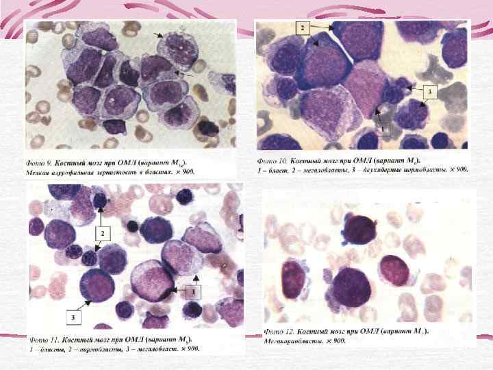 В основе проточной цитофлюориметрии лежит проведение фотометрических и флюоресцентных измерений отдельных клеток, пересекающих одна