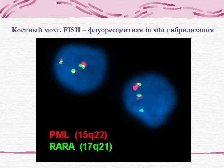  Проточная цитофлюориметрия Фотометрические каналы используются для оценки размера клеток (прямое светорассеивание – FS)